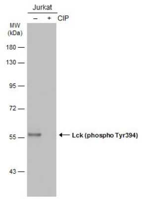 Western Blot: Lck [p Tyr394] Antibody [NBP3-13305]